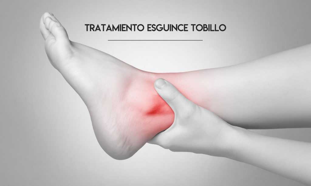 Esguince de tobillo