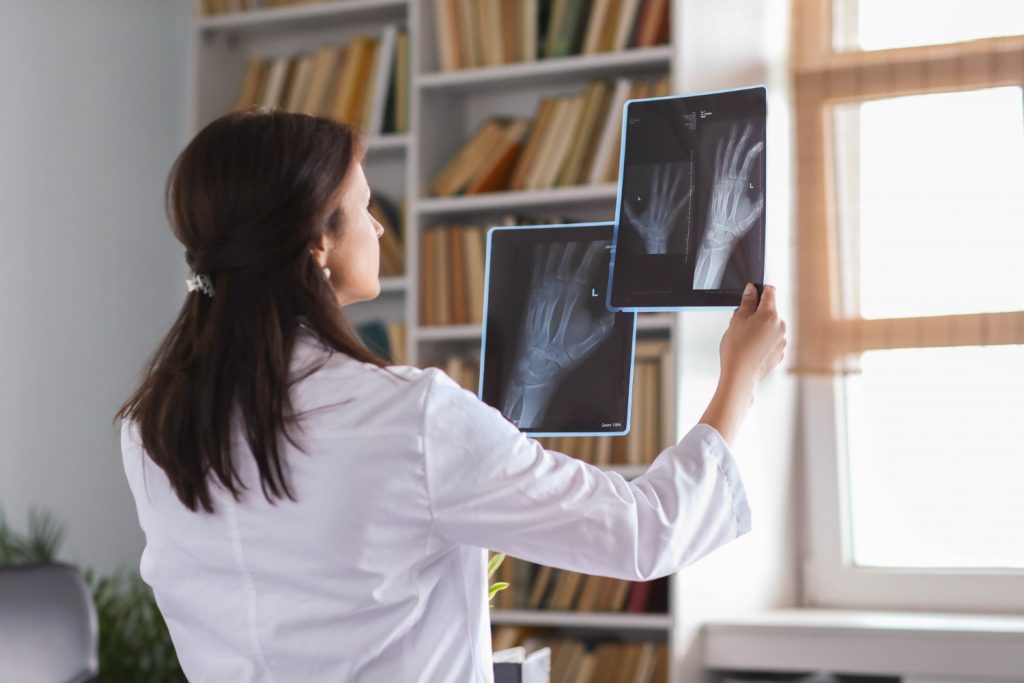 Radiografías: explorando el mundo de la imagen médica