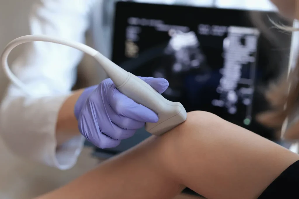 Ecografía de Rodilla: Lo que debes saber antes de pedir hora