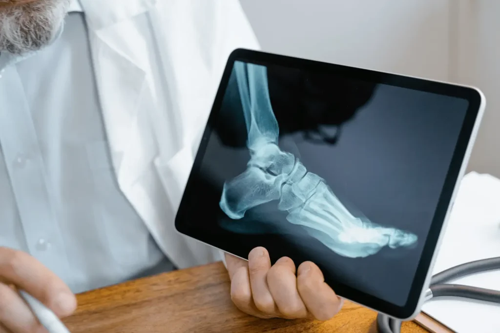 ¿Qué es una fisura y cómo se diferencia de una fractura?
